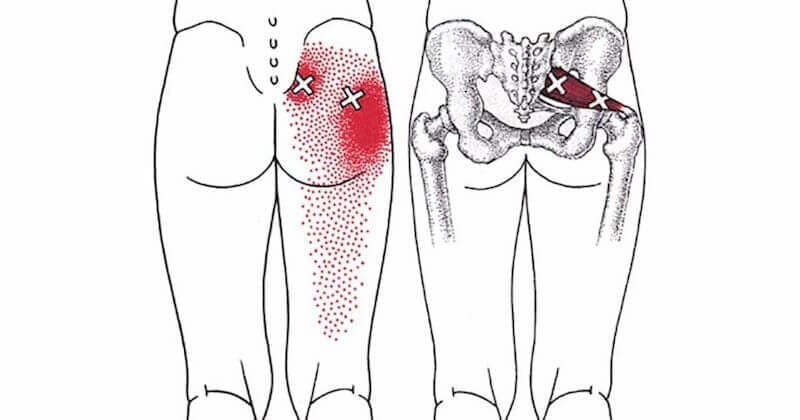 stretches piriformis syndrome pain el paso tx.