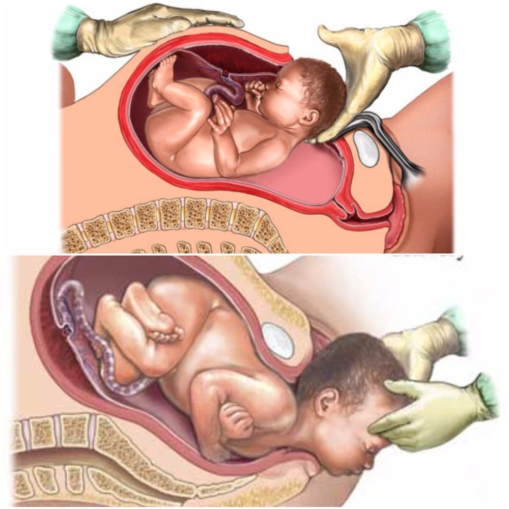 11860 Vista Del Sol, Ste. 128 Microbiome : Vaginal vs Caesarean El Paso, TX.