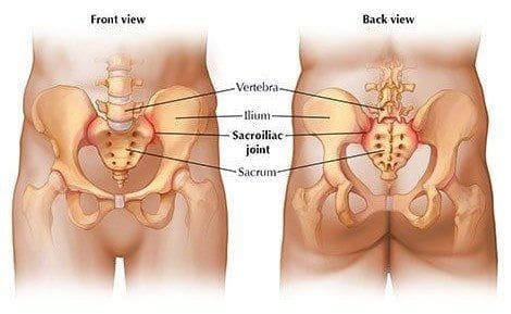 sacroiliac joint dysfunction el paso tx.