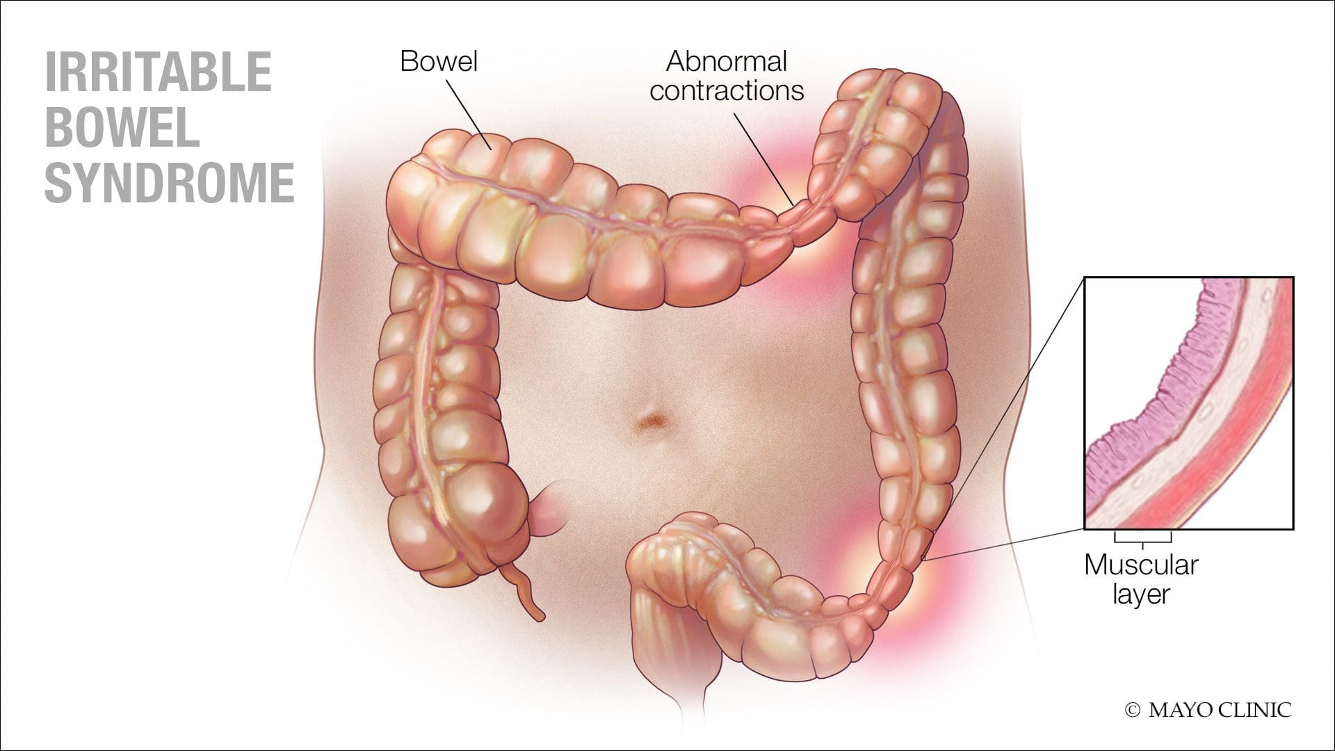 IBS-1920x1080.jpg