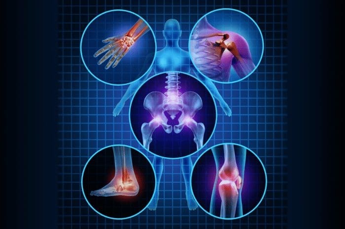 inflammed joints